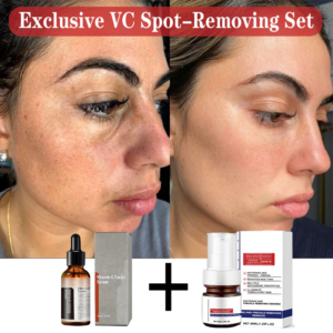 【dermatologist recommended】 vc spot correction & whitening cream set
